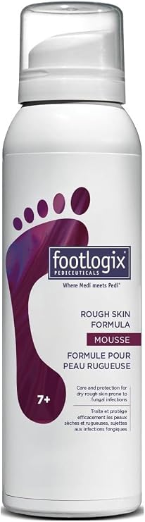 Footlogix Rough Skin Mousse Formula 125ml – Improves the Look of Dry, Flaky, Cracked Feet – For Rough Skin, Thick Heels, and Suitable for Diabetic Skin – Safe for All Skin Types