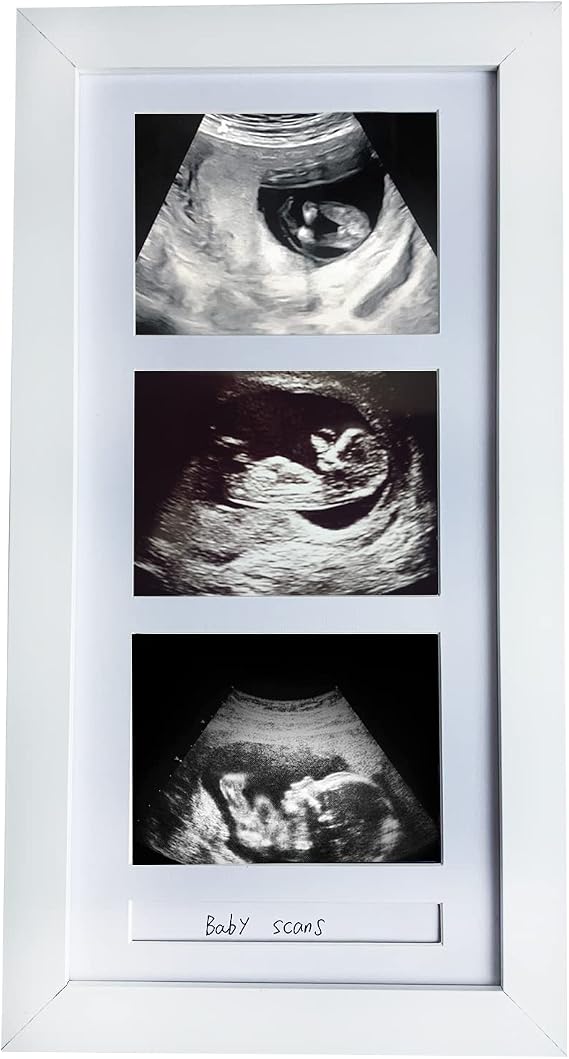Pine Wood Triple Ultrasound Frame, 3 Sonogram Photos, White