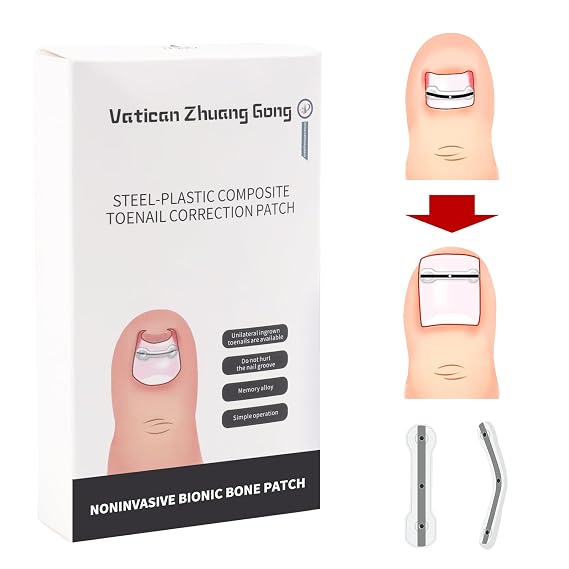 TADOPRO Ingrown Toenail Treatment,Titanium Alloy Silicone Ingrown Correction Patch Tool 10 pcaks, Tools Ingrown Toenail Removal Kit for Curved Nail Repair,at Home Nail Kit Tools