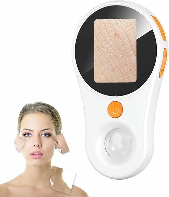 Digital Microscope with 500X Magnification and Fixed Focus for Skin Examination