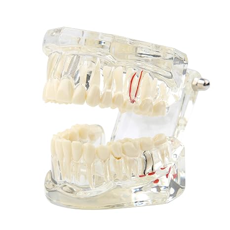 Dental Transparent Disease Teeth Model, Clear