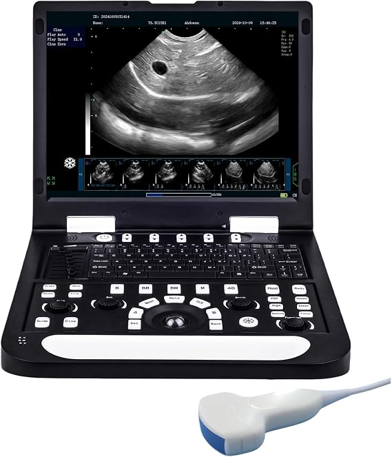 N60 Portable Veterinary Ultrasound Machine, 15" LCD
