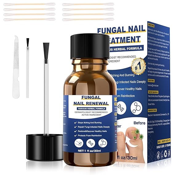 Toenail Fungus Treatment,Foot Fungus Treatment Extra Strength,Fungus Nail Treatment, Toe Nail Fungus Treatments For Fungi Nail yellow toenail treatment(1fl oz/30ml)